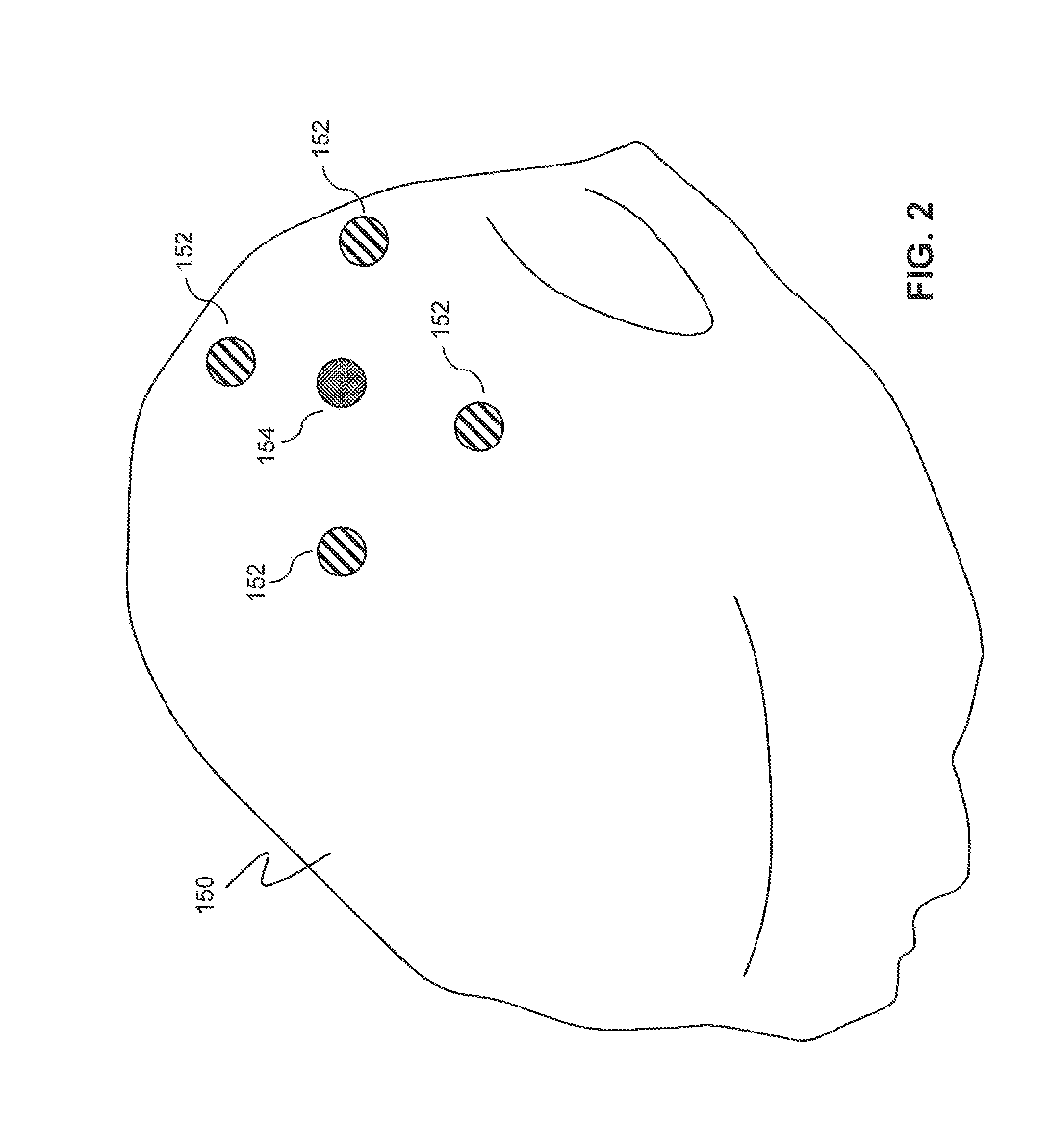 Wearable, unsupervised transcranial direct current stimulation (tDCS) device for movement disorder therapy, and method of using