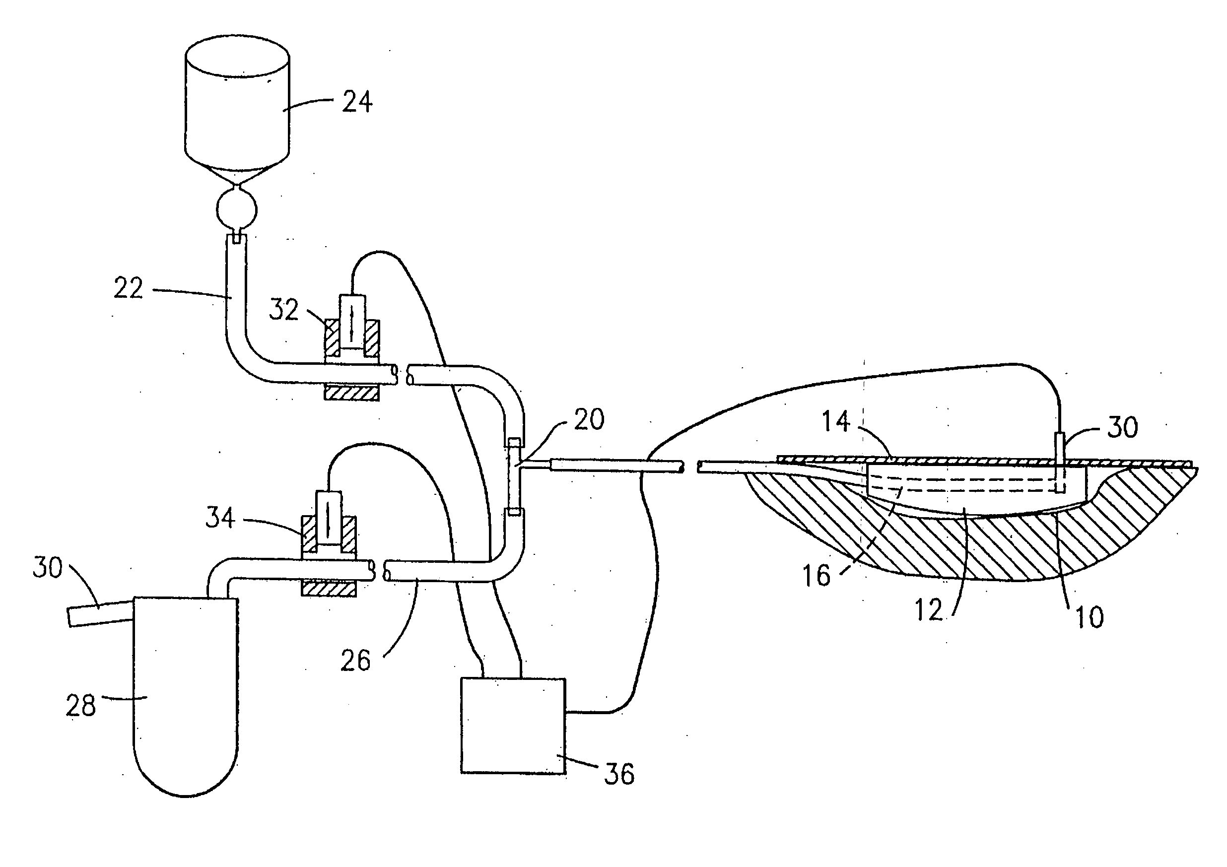 Process and device for application of active substances to a wound surface