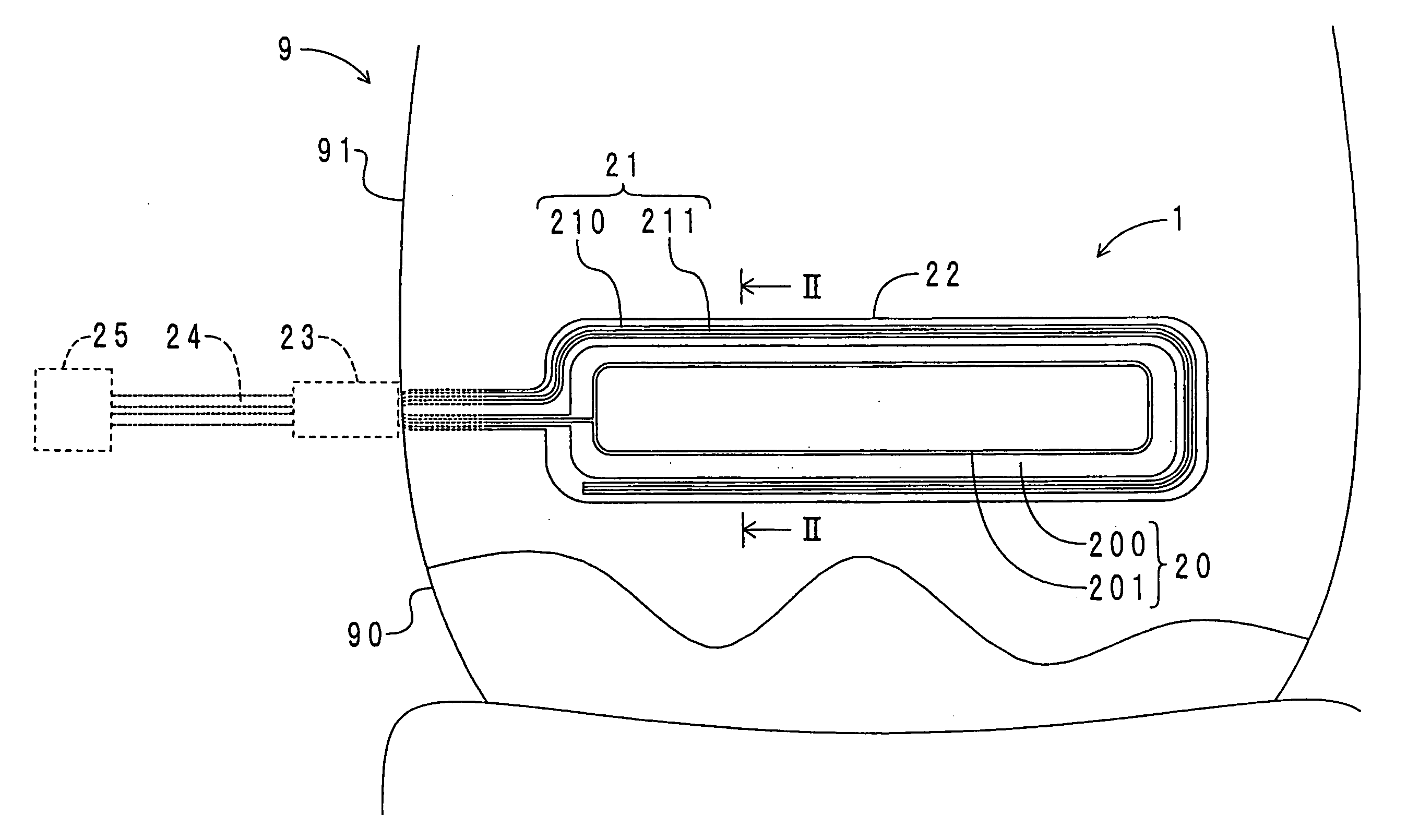 Capacitance type sensor and occupant detection system having the same