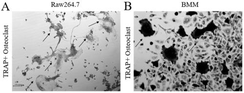 Method for obtaining RANKL recombinant protein with biological activity and application of RANKL recombinant protein with biological activity