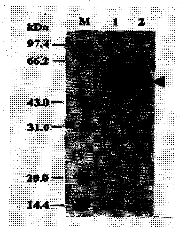 Yeast expression method for recombining major protein AccMRJP1 of apis cerana royal jelly and product application