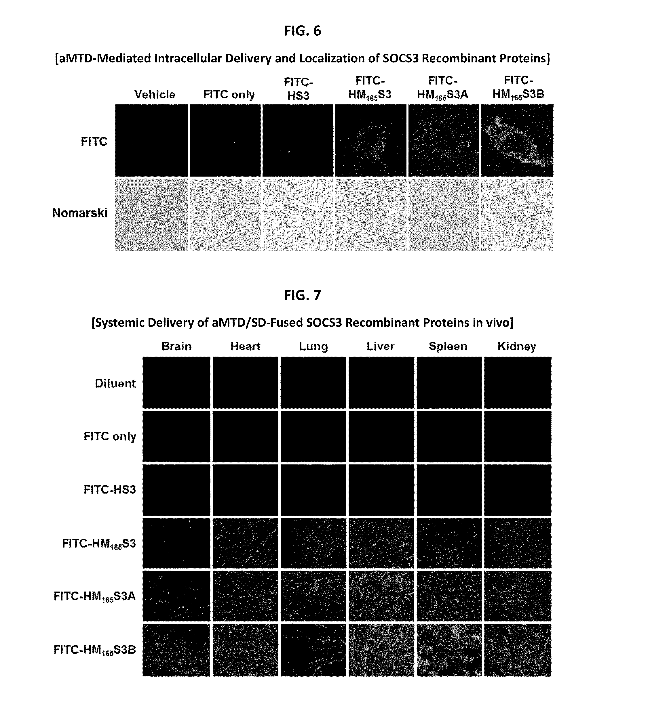 Development of a Protein-Based Biotherapeutic Agent That Penetrates Cell-Membrane and Induces Anti-Tumor Effect in Solid Tumors - Improved Cell-Permeable Suppressor of Cytokine Signaling (iCP-SOCS3) Proteins, Polynucleotides Encoding the Same, and Anti-Tumor Compositions Comprising the Same