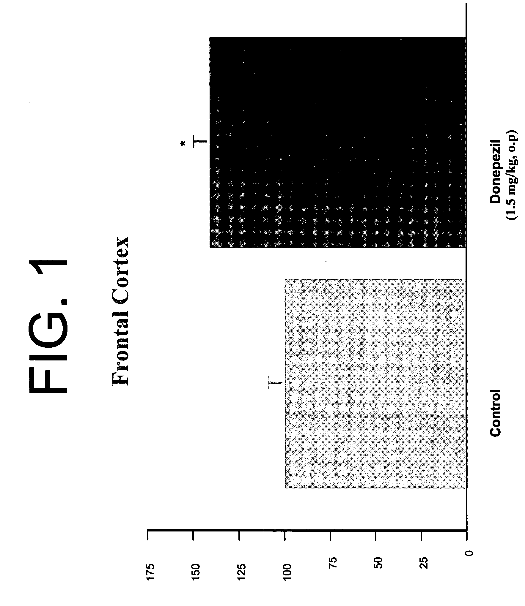 Combinatorial therapy with an acetylcholinesterase inhibitor and (3aR)-1,3a,8-trimethyl-1,2,3,3a,8,8a-hexahydropyrrolo[2,3,-b]indol-5-yl phenylcarbamate