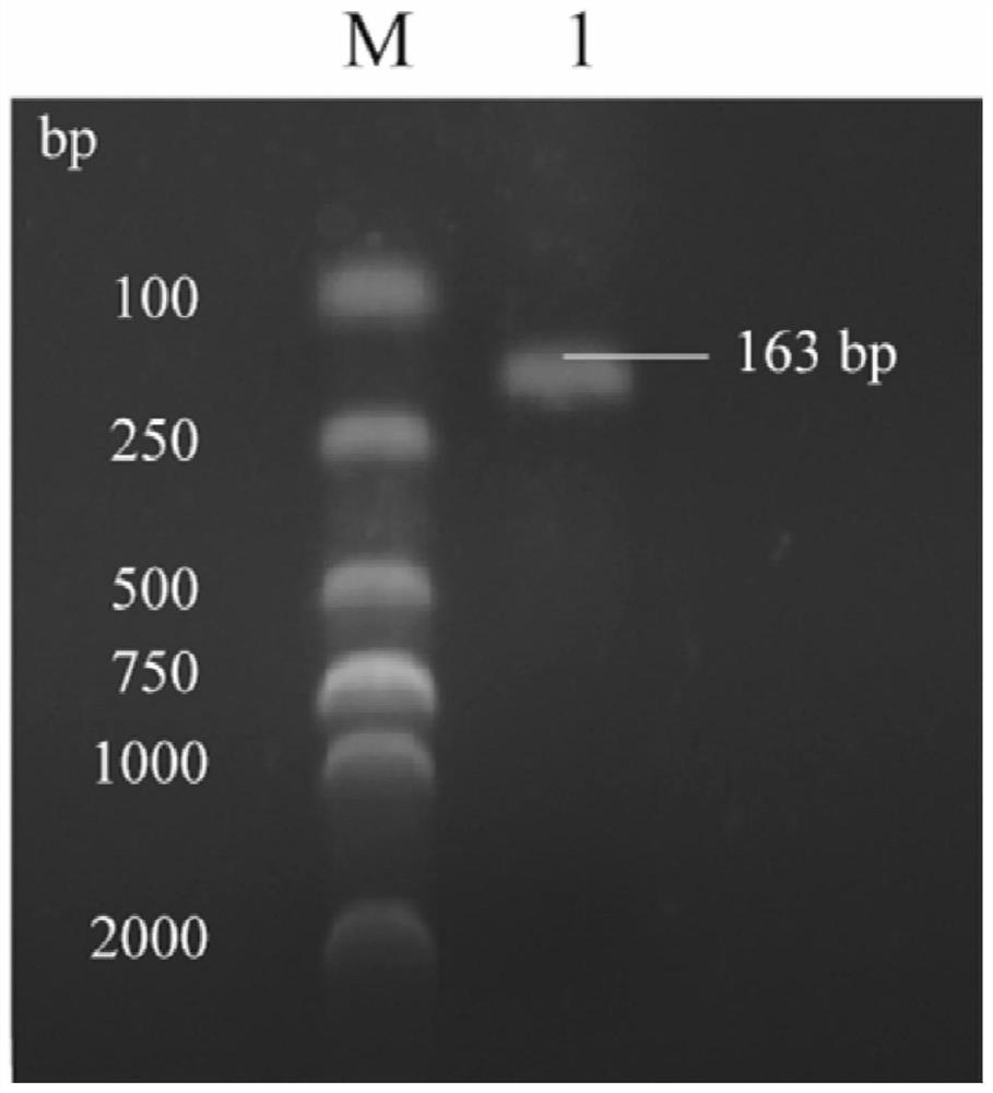 A method for isolating and culturing zebrafish primary intestinal macrophages