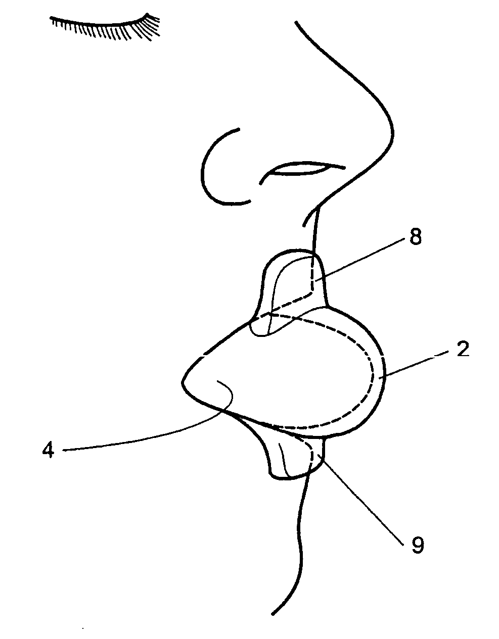 Tongue stabilising device