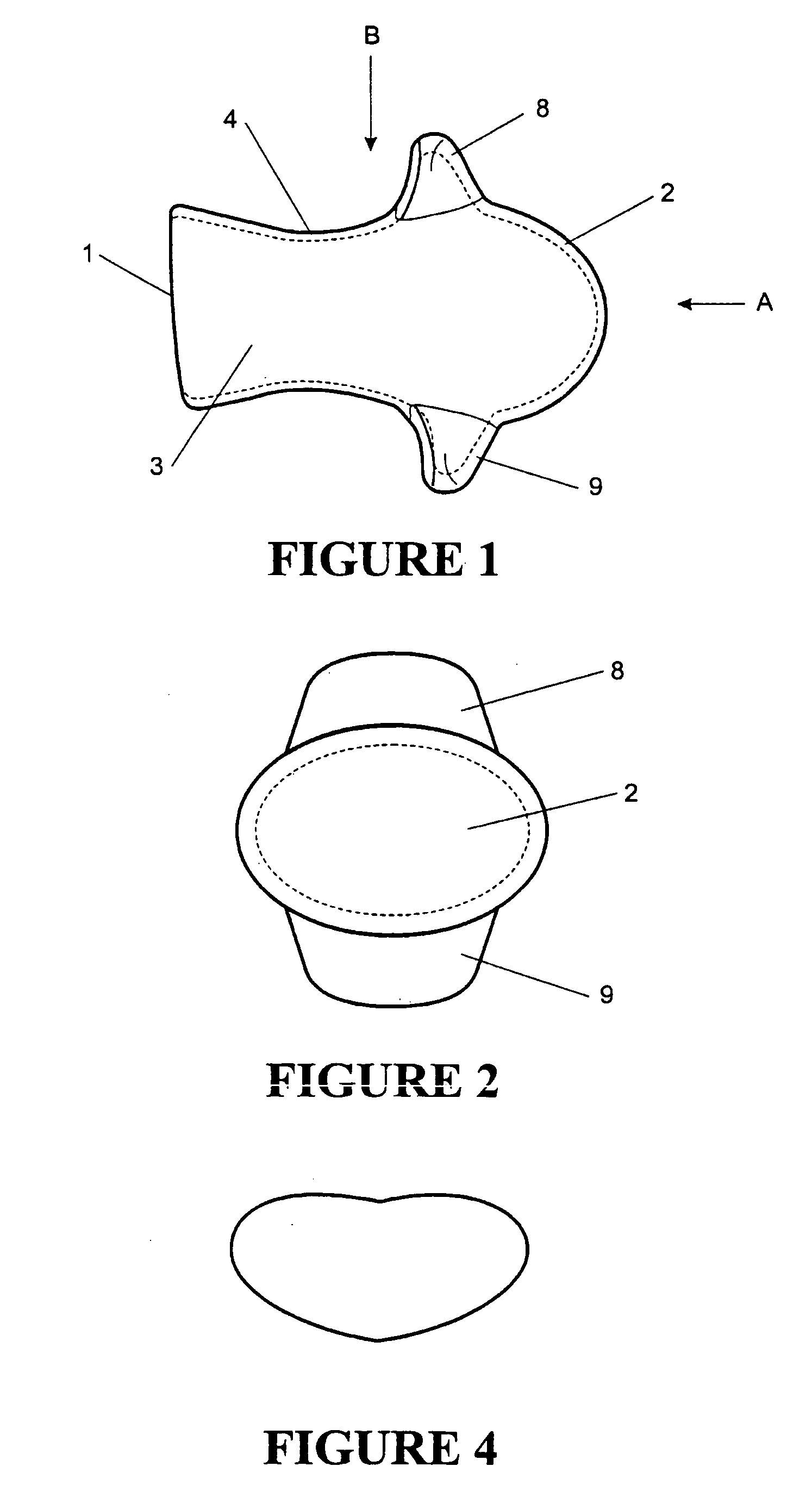 Tongue stabilising device