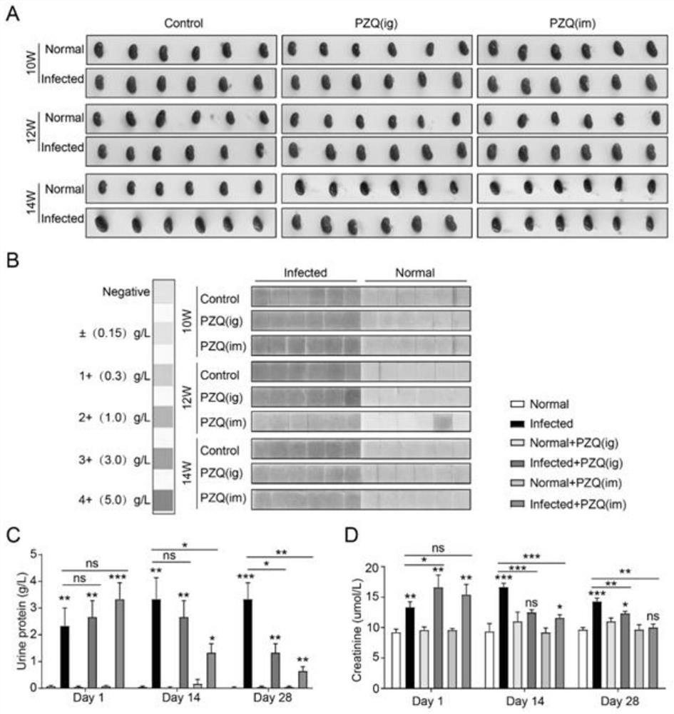 Application of praziquantel in resisting renal fibrosis diseases