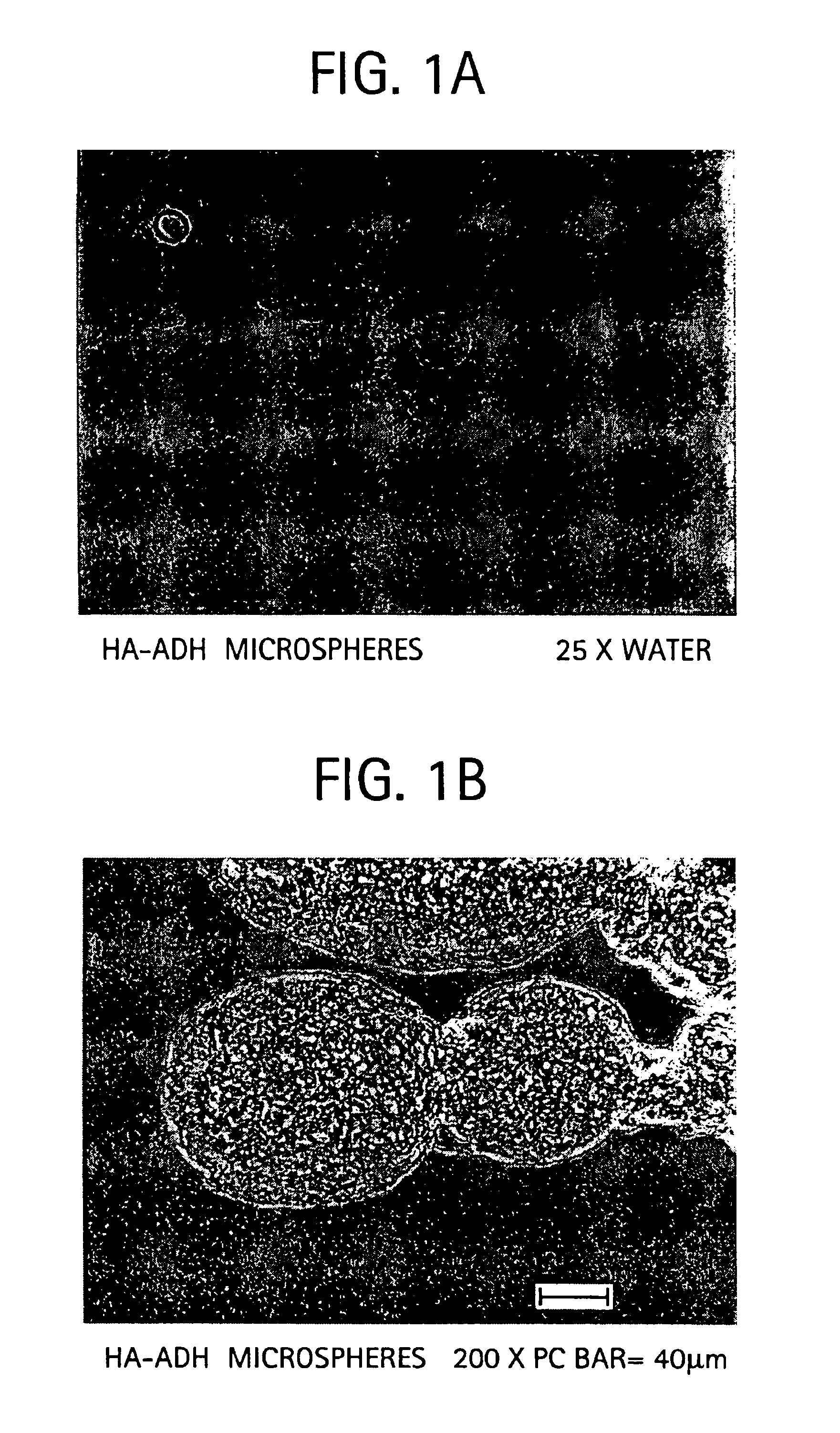 Sodium hyaluronate microspheres