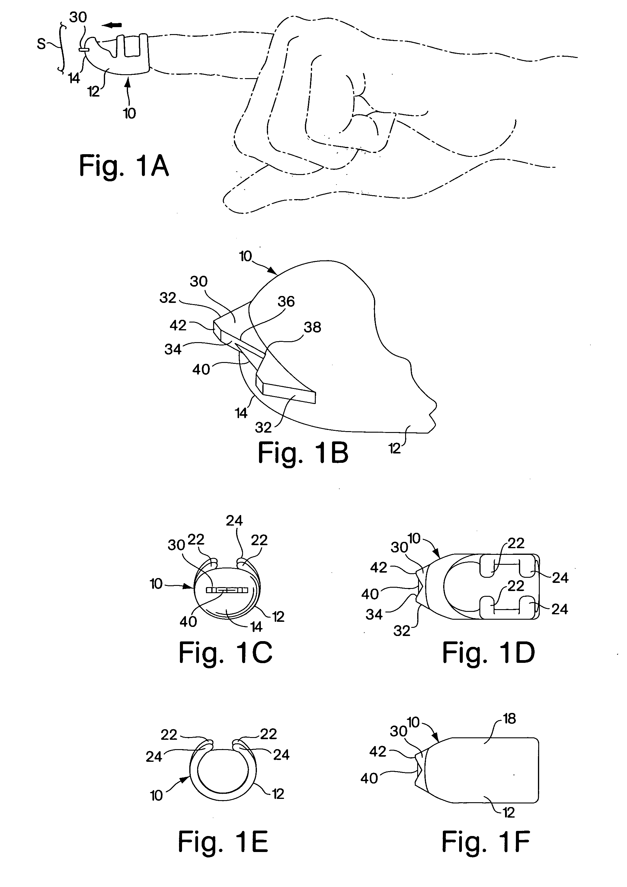 Fingertip suture-cutting apparatus