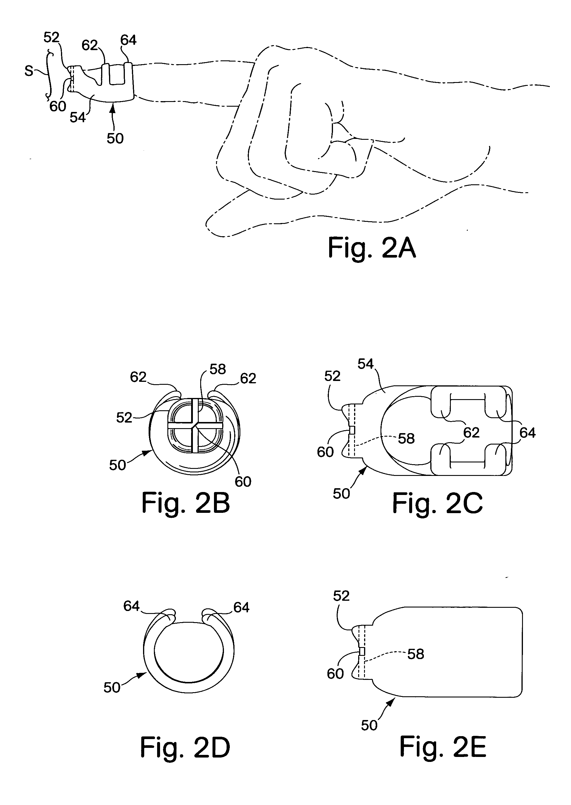 Fingertip suture-cutting apparatus