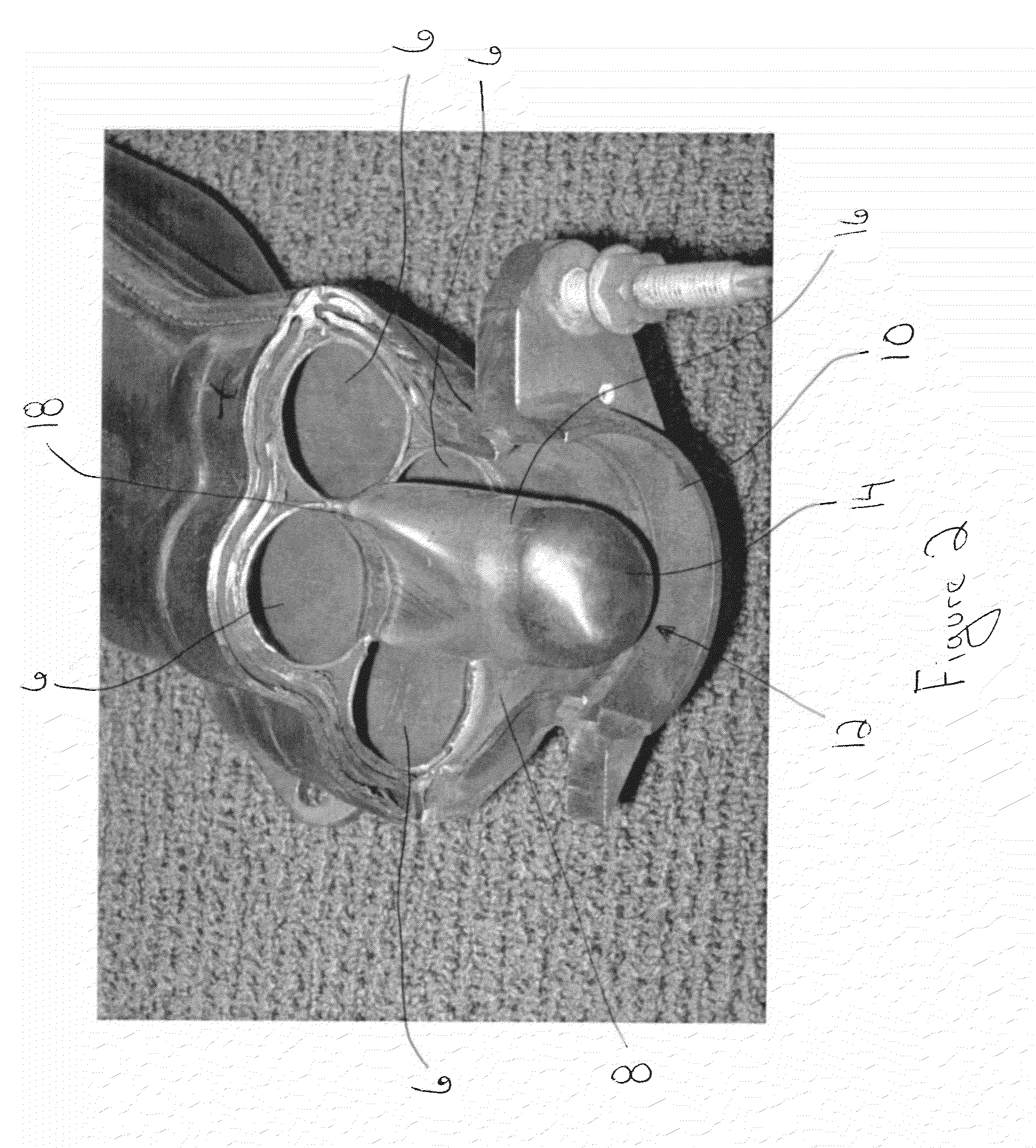 Method and device for exhaust gas management