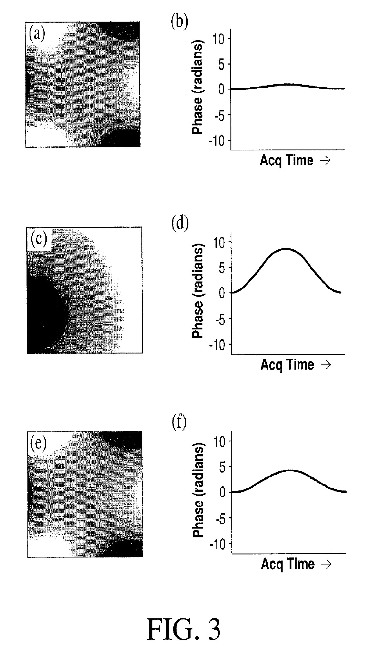 Single-echo imaging with nonlinear magnetic gradients