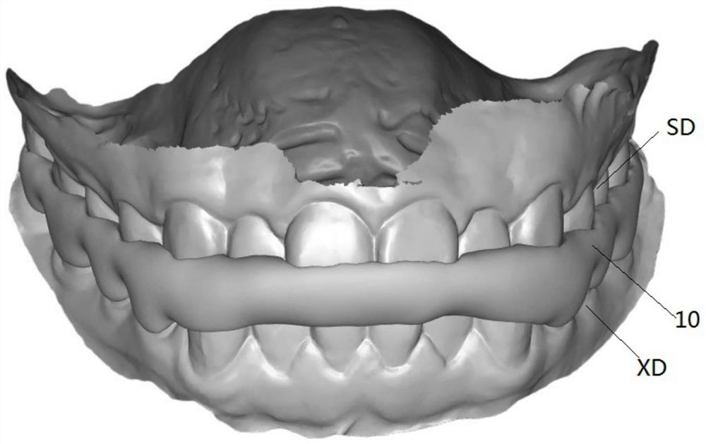 Customized temporomandibular joint repositioning occlusal pad and manufacturing and application methods thereof