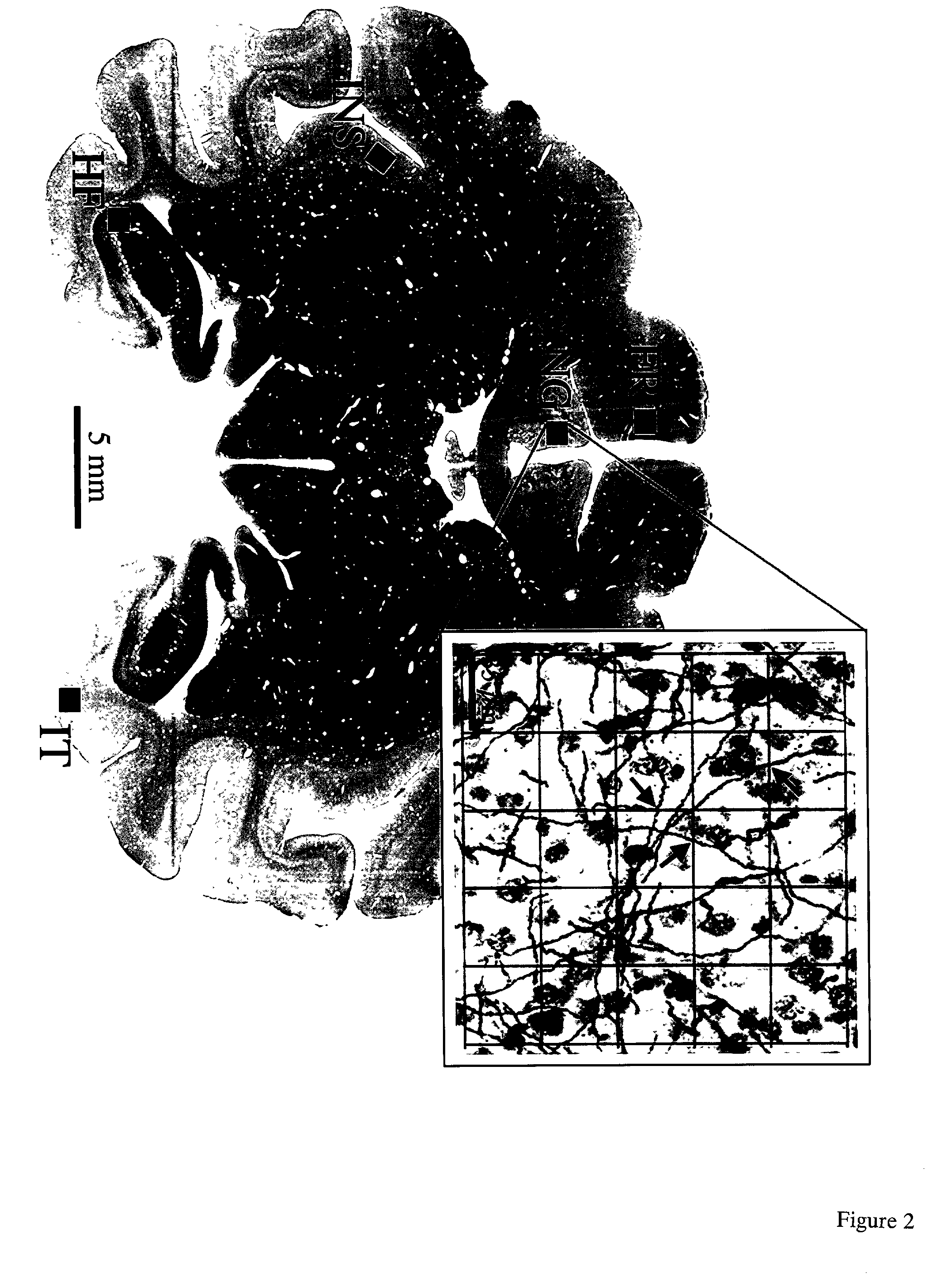 Methods for modulation of the effects of aging on the primate brain