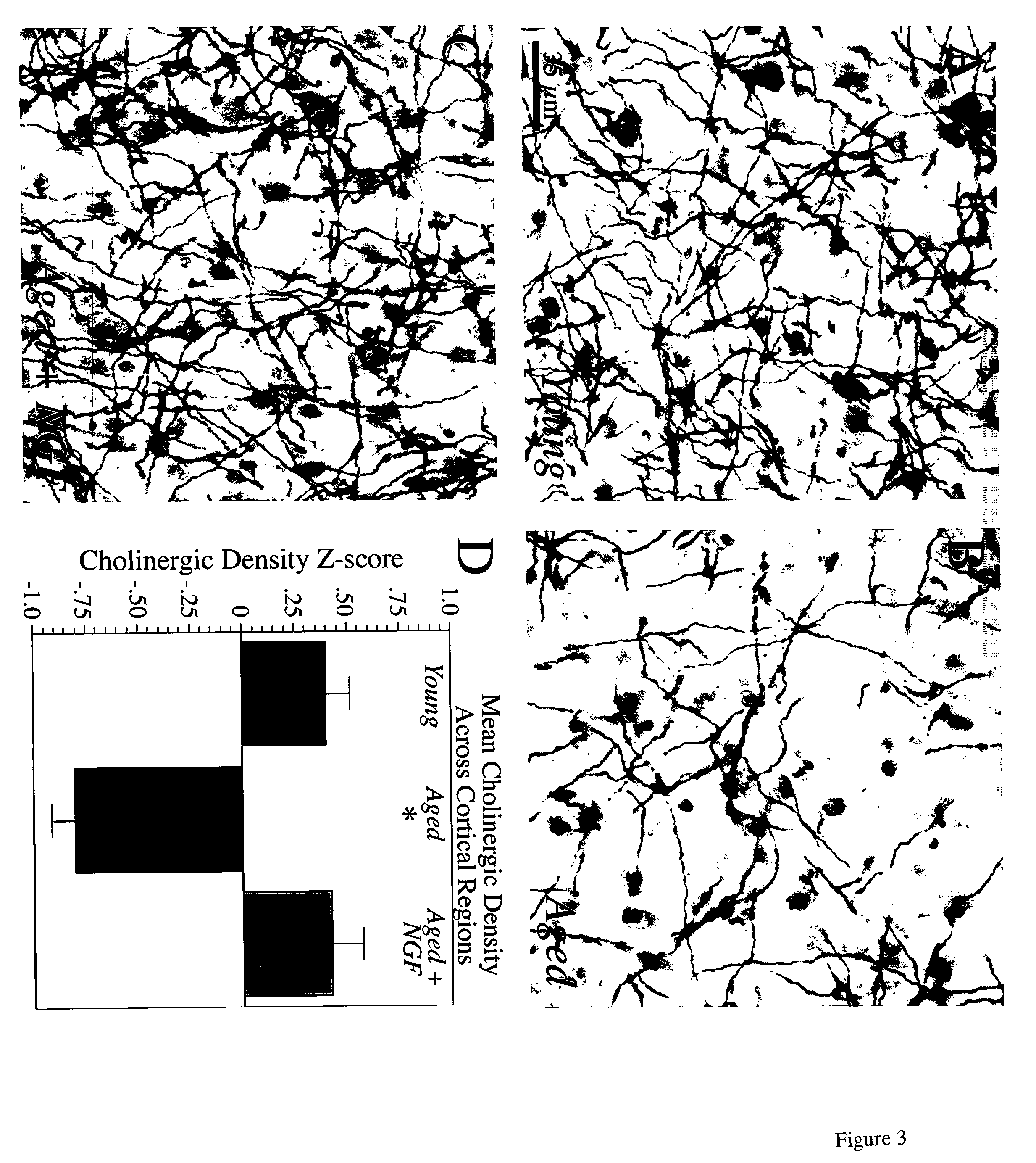 Methods for modulation of the effects of aging on the primate brain