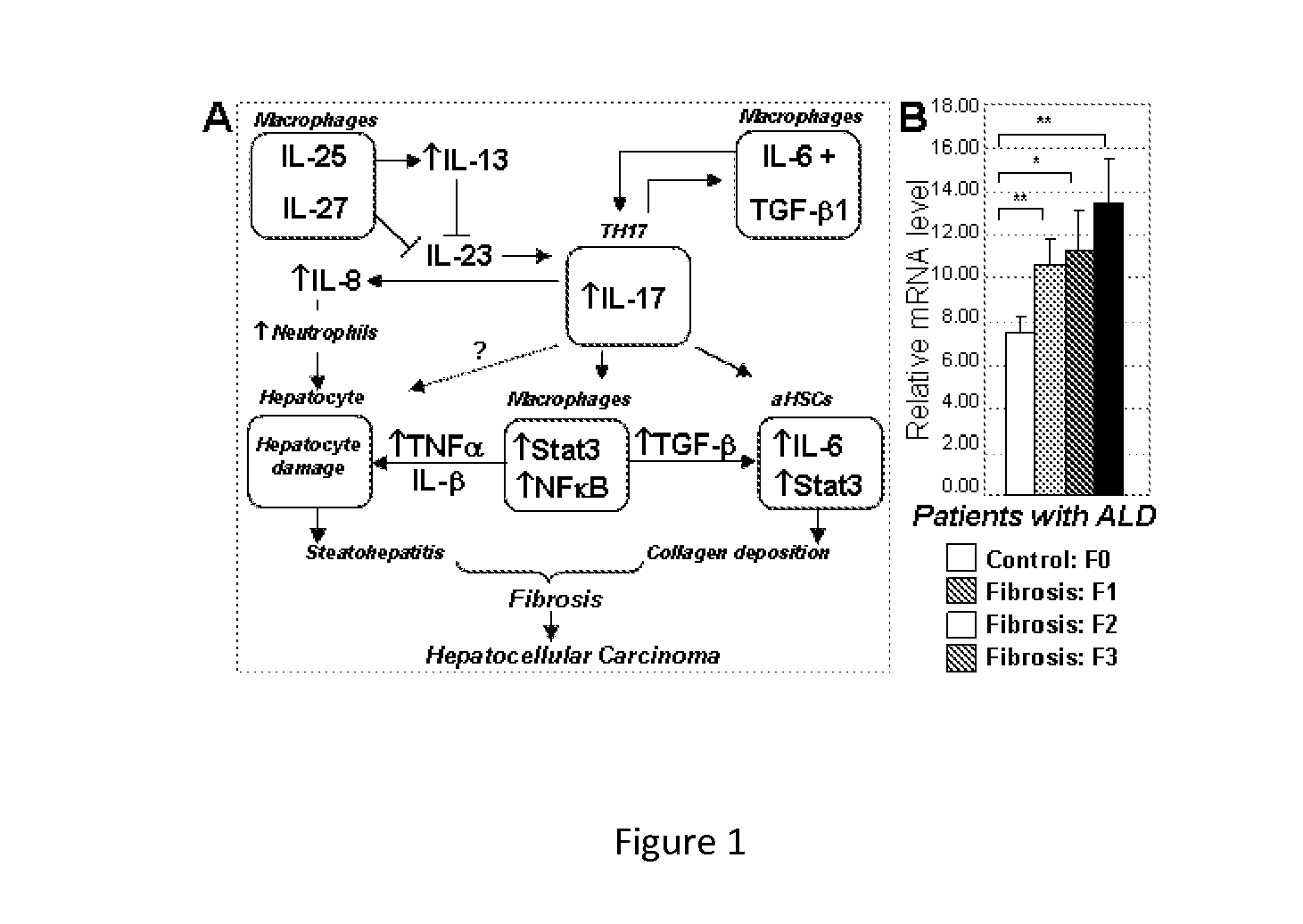 Compositions And Methods For Treating Steatohepatitis, Liver Fibrosis, and Hepatocellular Carcinoma (HCC)