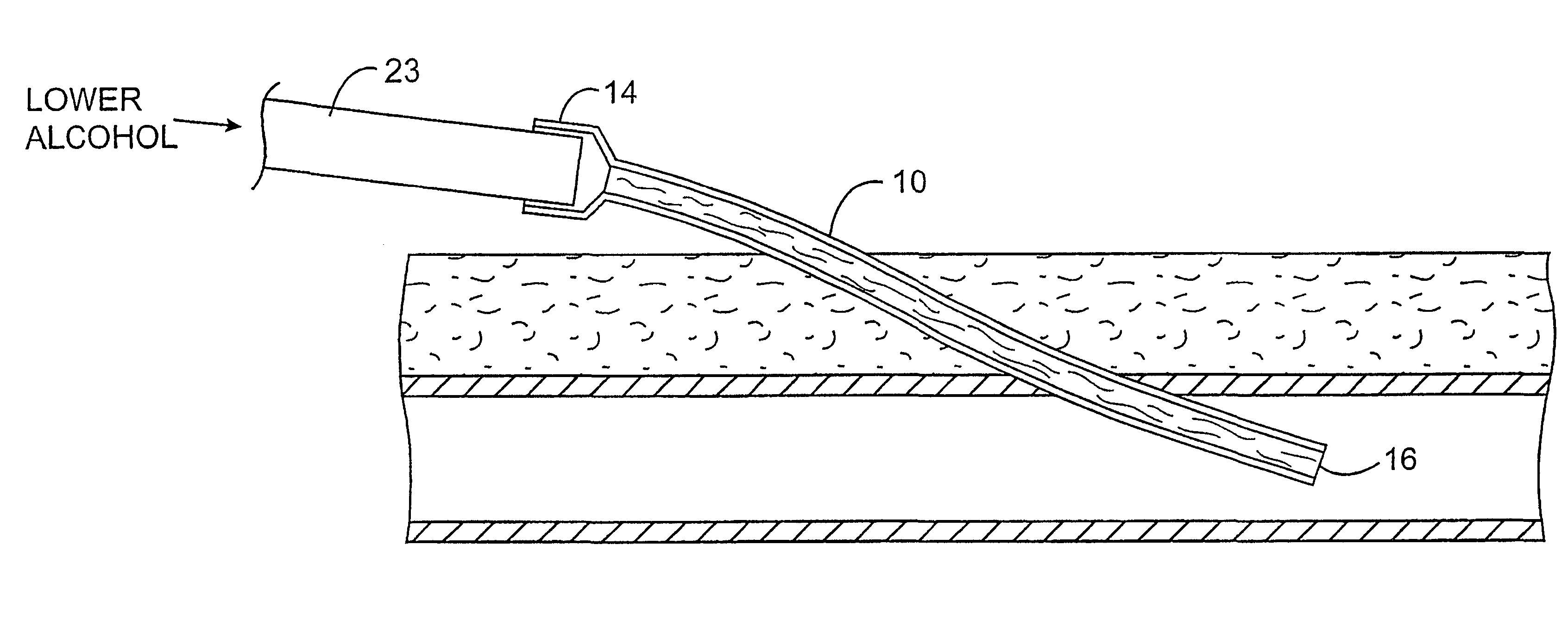 Methods and kits for locking and disinfecting implanted catheters