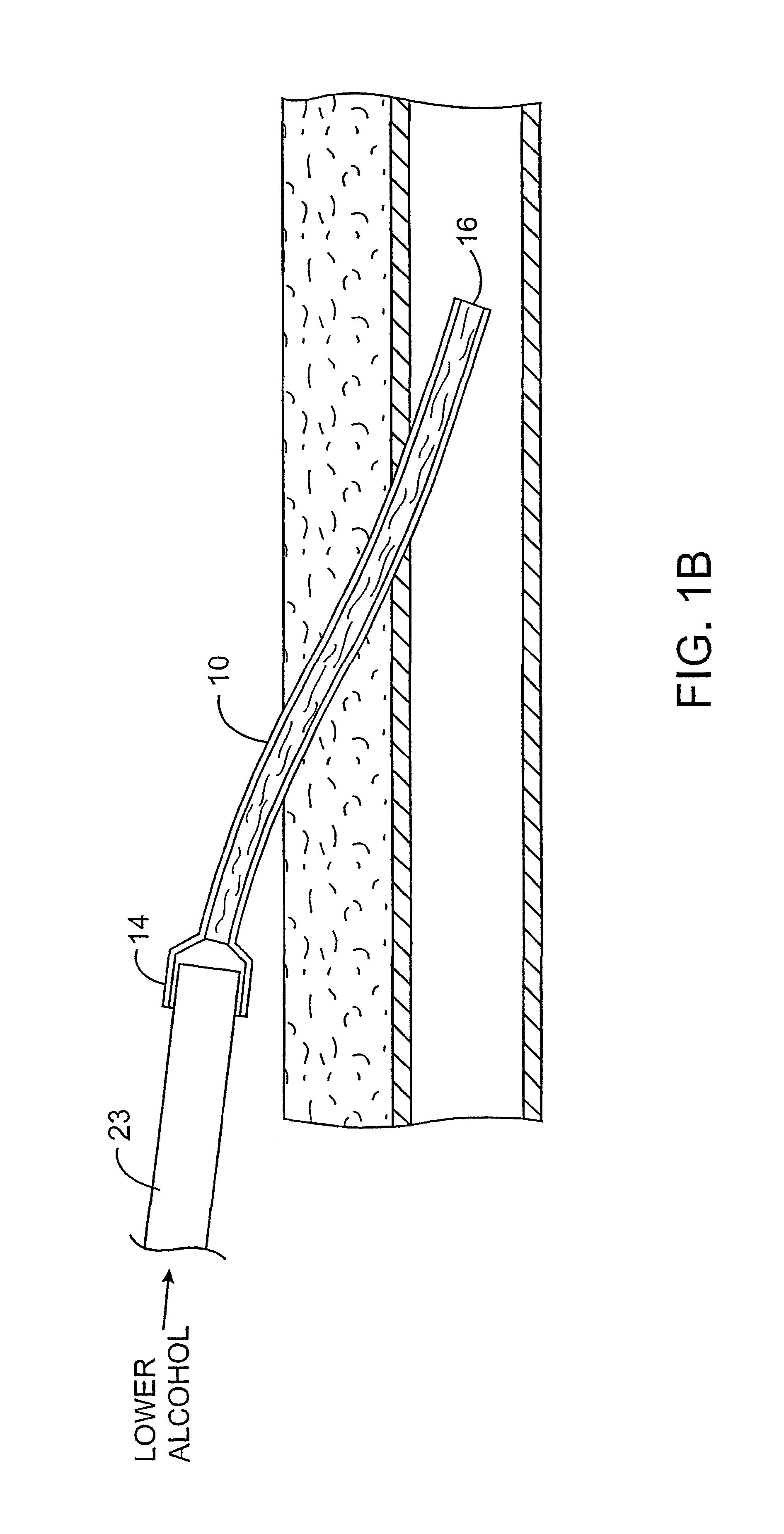 Methods and kits for locking and disinfecting implanted catheters