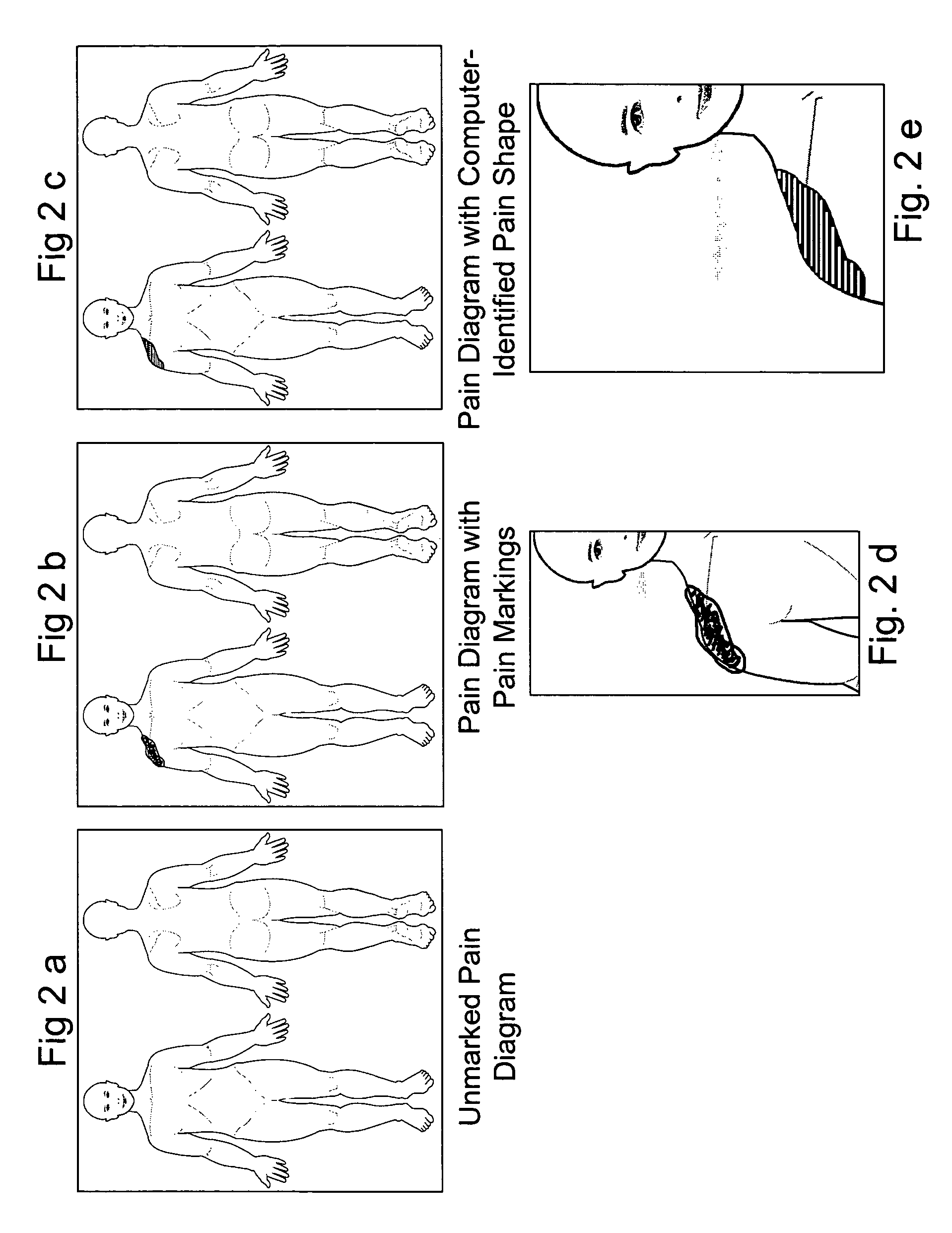 Method for analysis of pain images