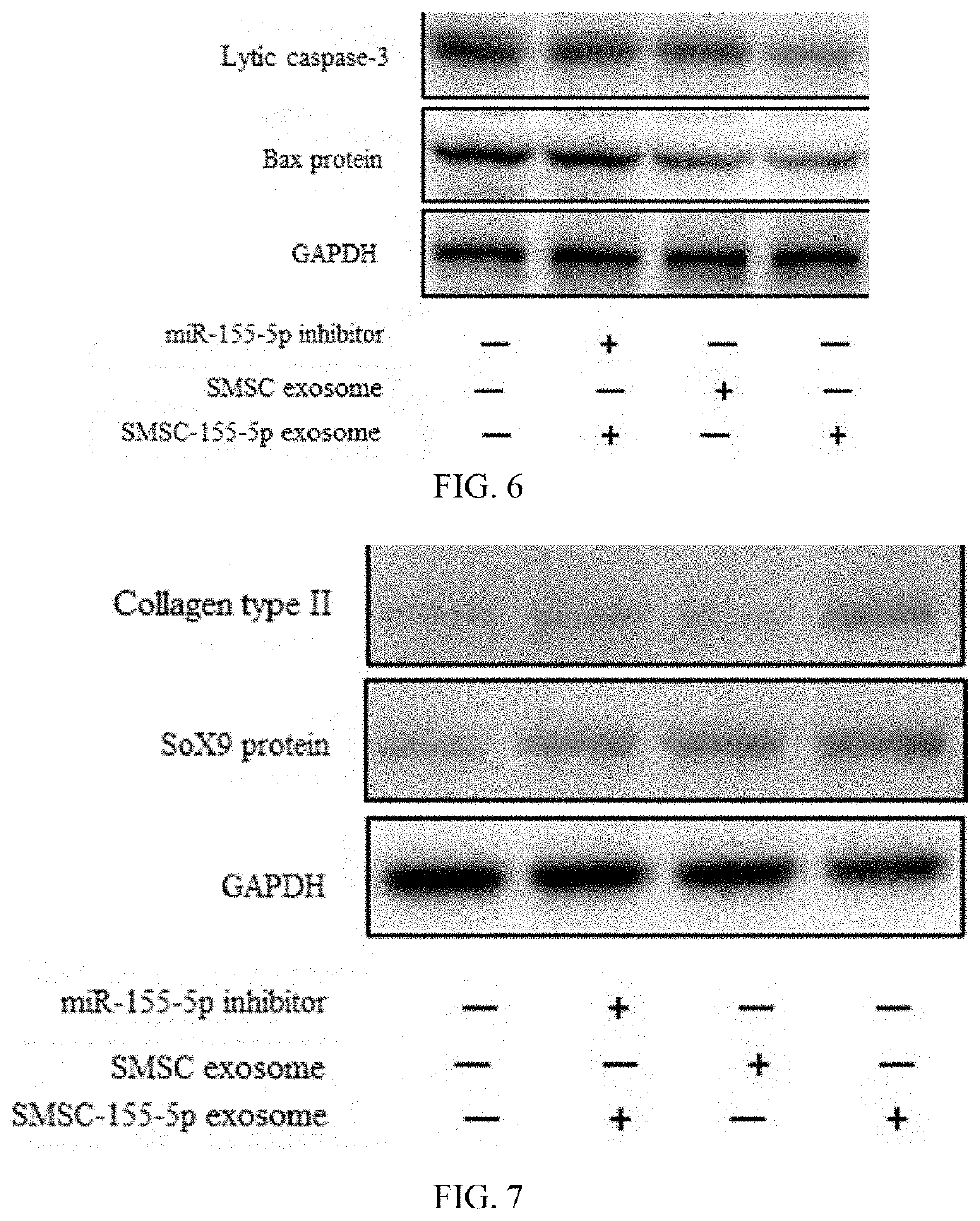 USE OF miRNA IN PREPARATION OF A DRUG FOR PREVENTING AND TREATING OSTEOARTHRITIS, AN EXOSOME HIGHLY EXPRESSING miRNA AND USE THEREOF