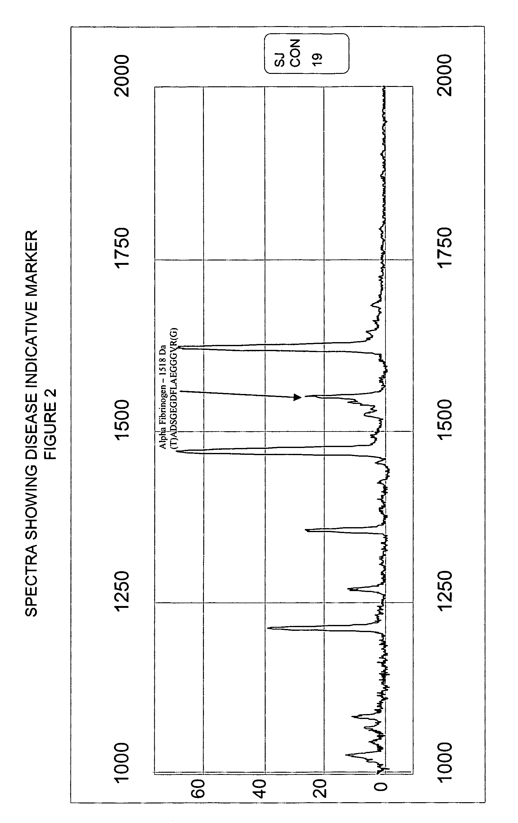 Method and kit for diagnosing myocardial infarction