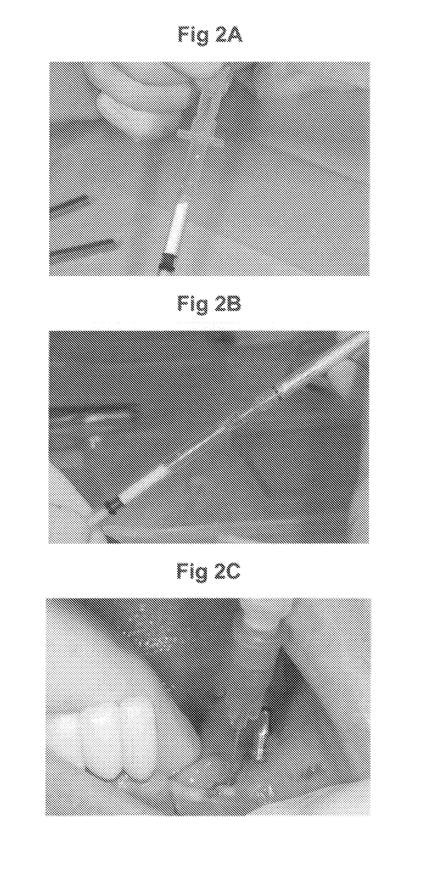 Bone graft and biocomposite for prosthetic dentistry