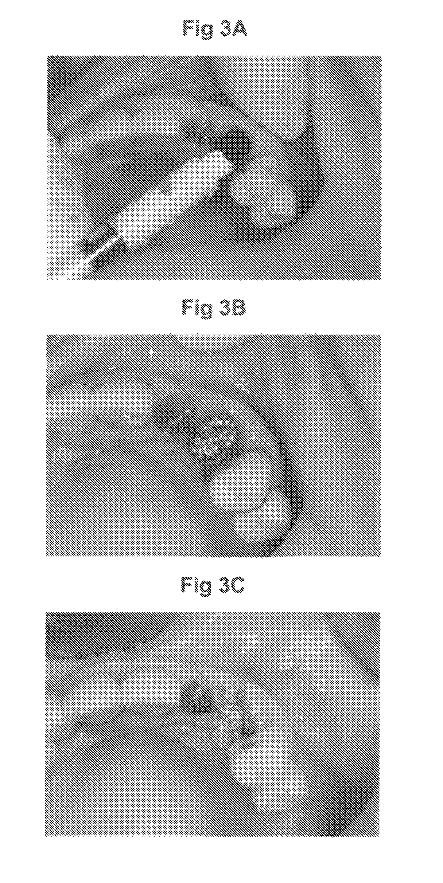 Bone graft and biocomposite for prosthetic dentistry