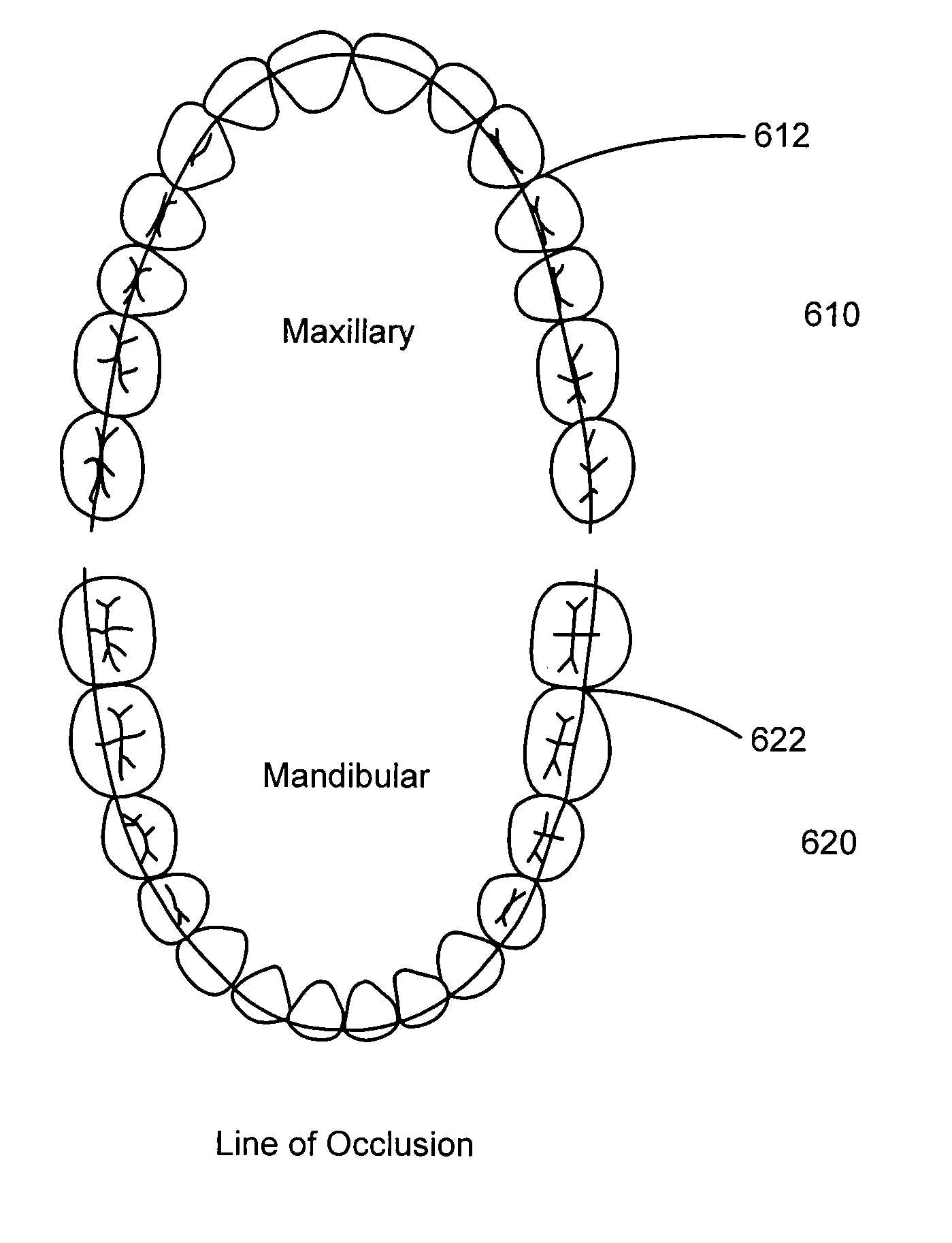 System and method for automatic detection of dental features