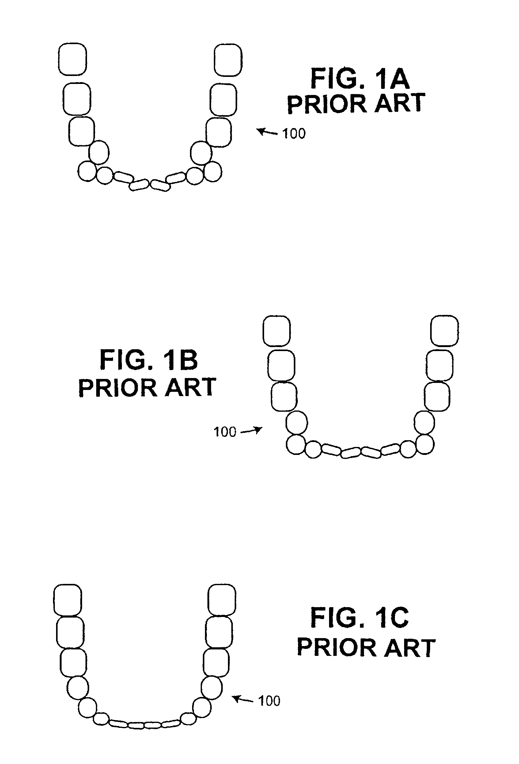 System and method for automatic detection of dental features