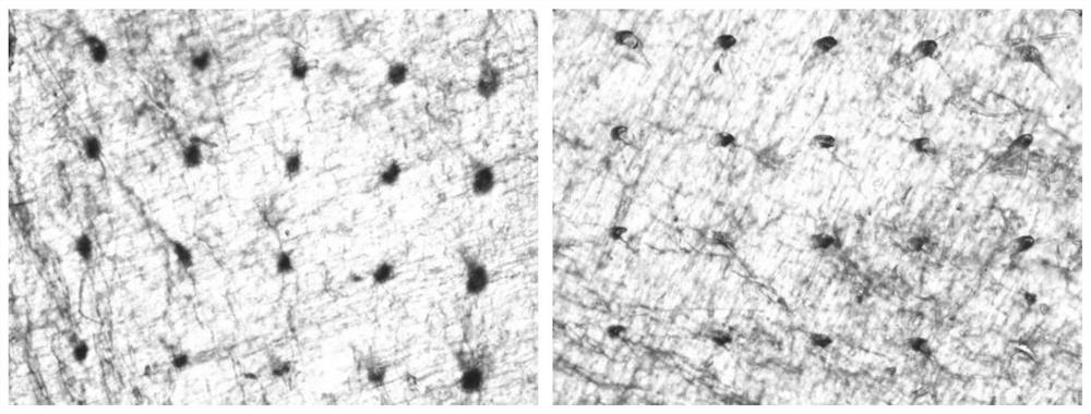 Preposed cavitation type marihuana fat-soluble active matter soluble microneedle as well as preparation method and application thereof