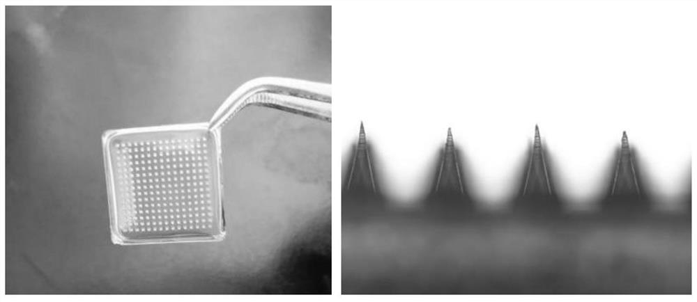 Preposed cavitation type marihuana fat-soluble active matter soluble microneedle as well as preparation method and application thereof