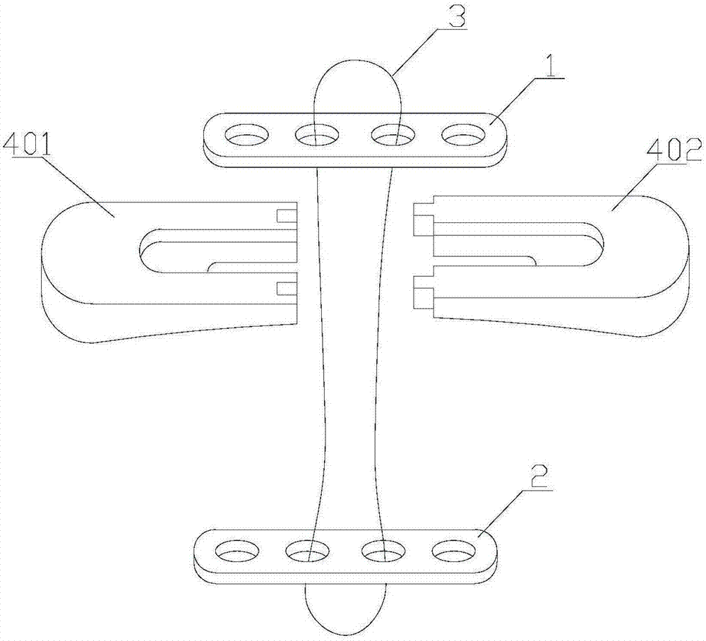 Coracoclavicular ligament reconstruction device