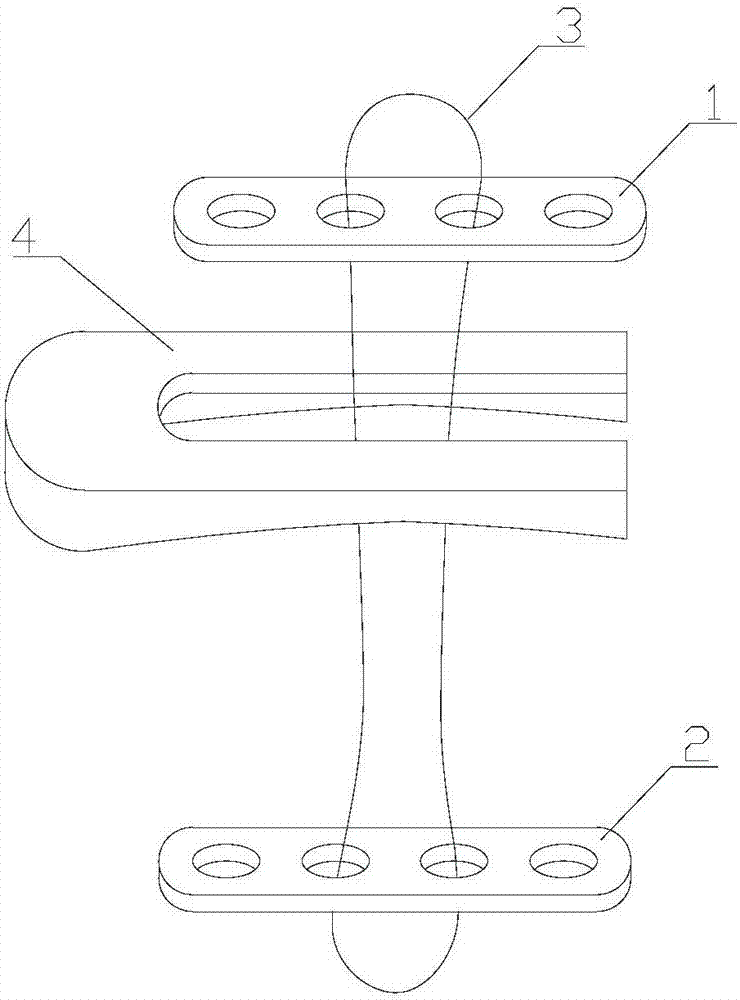 Coracoclavicular ligament reconstruction device