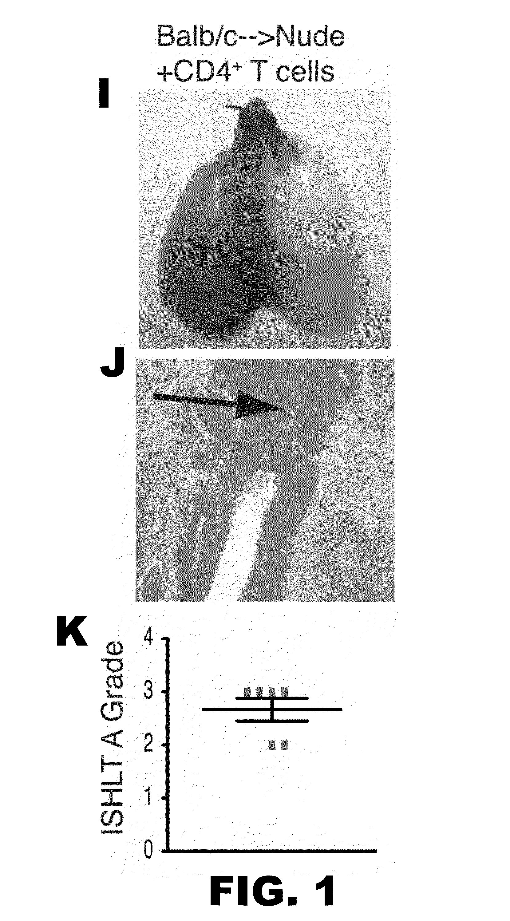 Induction of tolerance in lung allograft transplantation