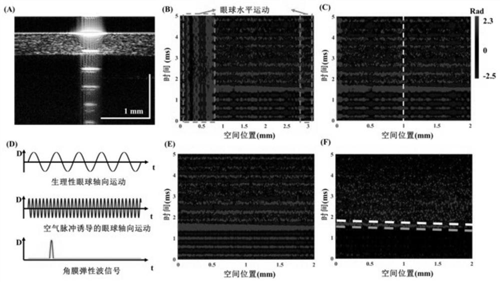 A method for measuring corneal elastic modulus in vivo based on jet optical coherence elastography
