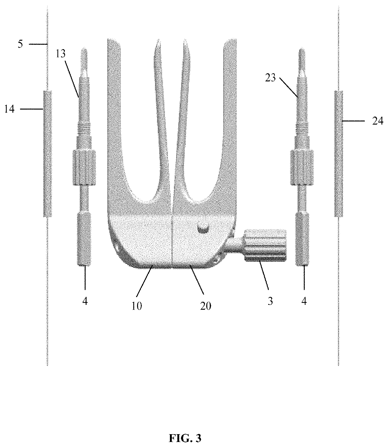 Achilles tendon suture apparatus and method of using same