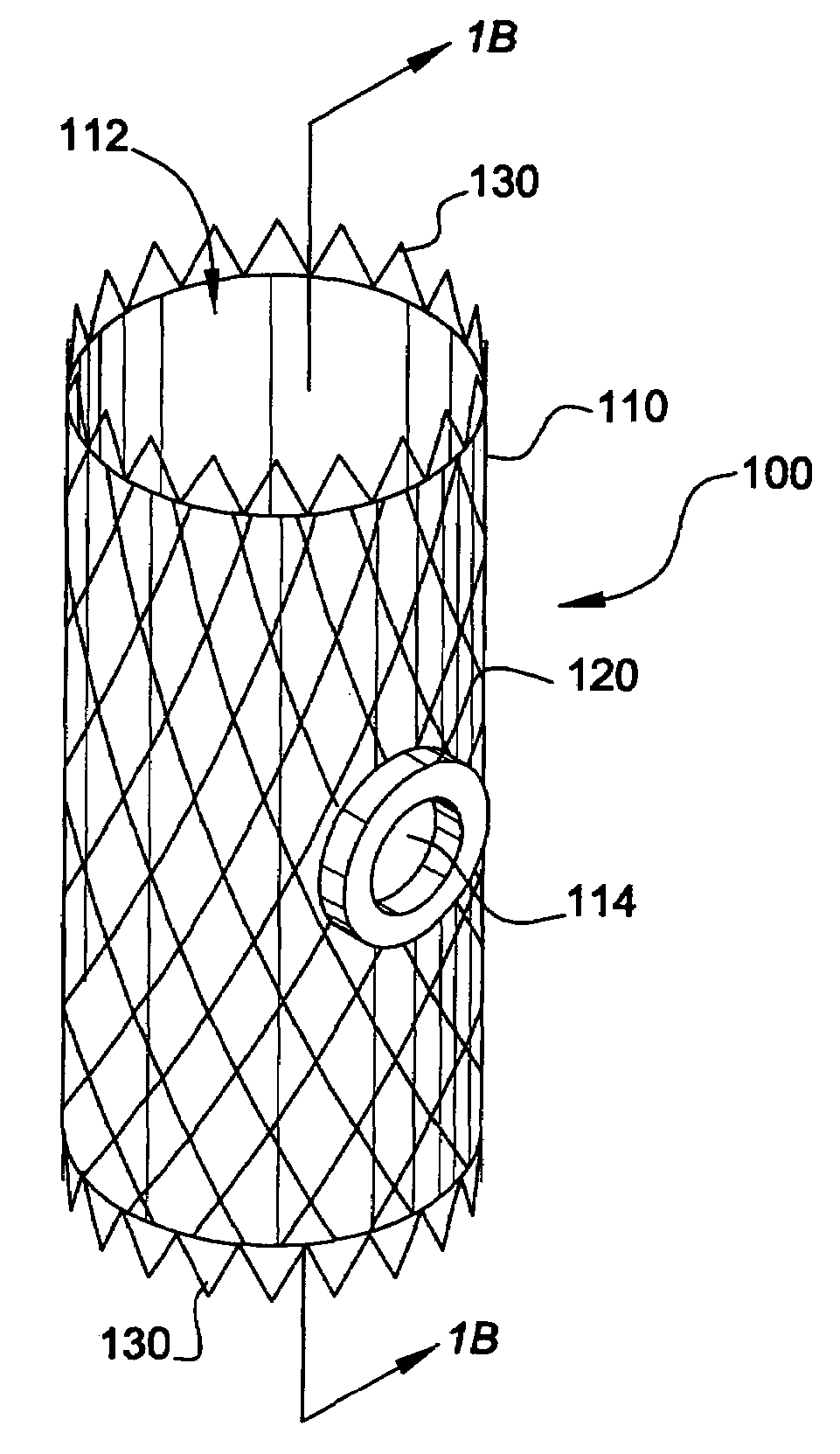 System and method for endoluminal grafting of bifurcated and branched vessels