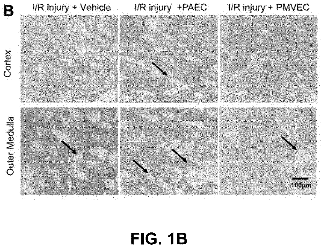 Compositions and methods for the treatment or prophylaxis of a perfusion disorder