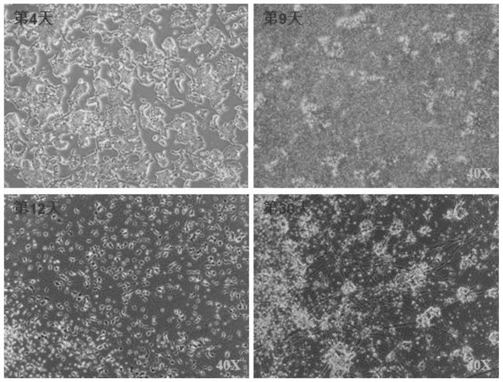 A kind of motor neuron and its preparation method and application