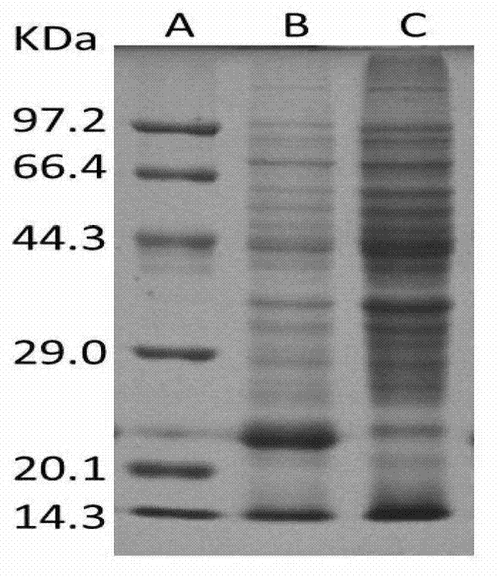 Application of recombinant human cell globin in preparation of fatty liver medicament