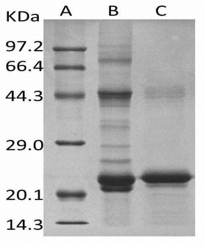 Application of recombinant human cell globin in preparation of fatty liver medicament