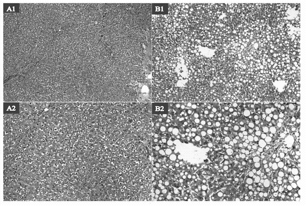 Application of recombinant human cell globin in preparation of fatty liver medicament