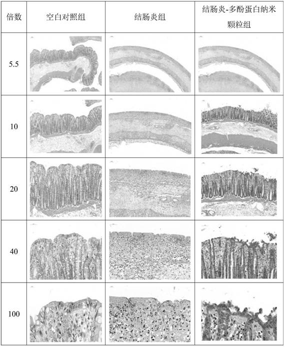 Preparation method of polyphenol-protein nanoparticles for relieving colitis