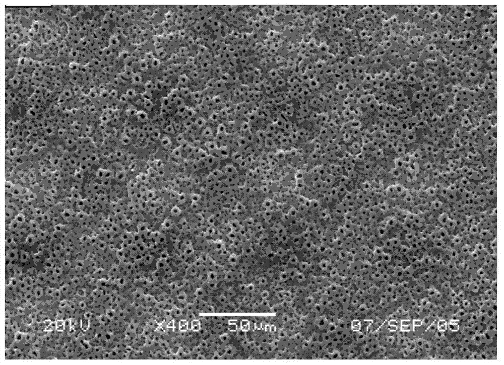 Preparation method of tissue suitable type composite material dental implant