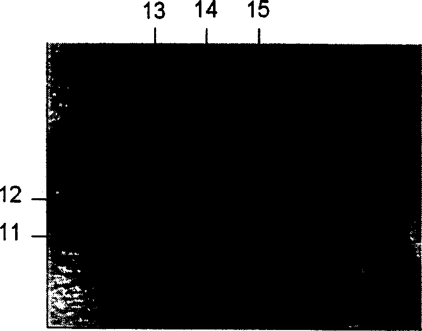 Living body iris patterns collecting method and collector