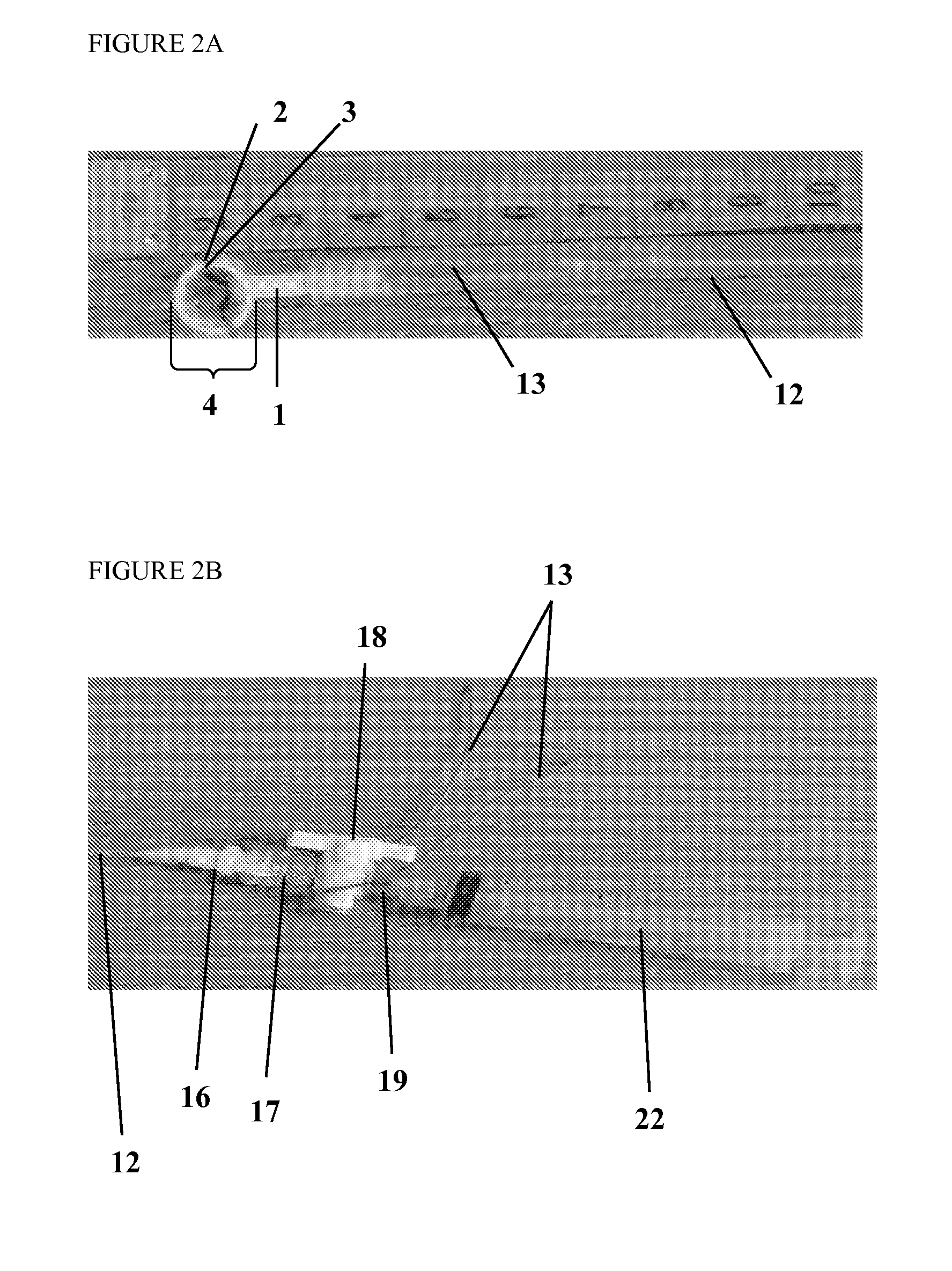 Probe for diagnosis and treatment of muscle contraction dysfunction