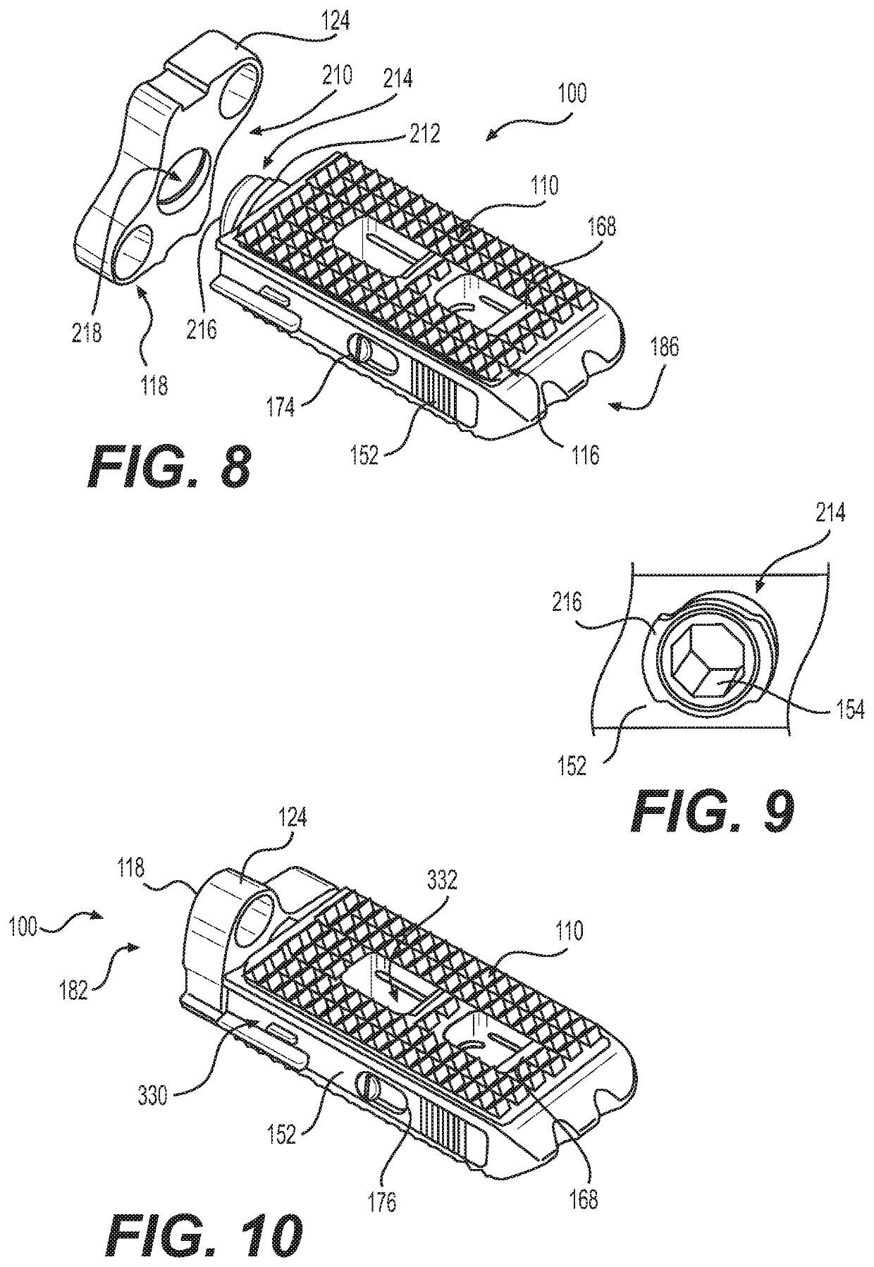 Expandable vertebral implant