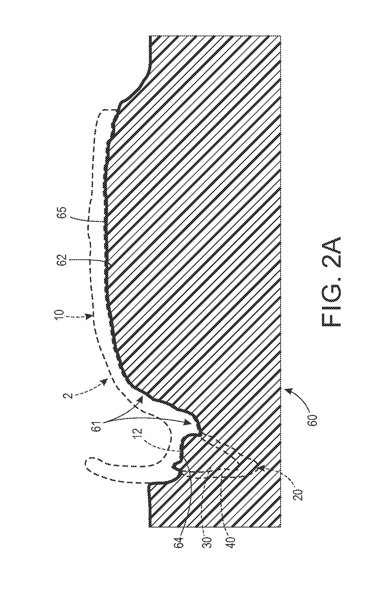 Molded denture and method and apparatus of making same