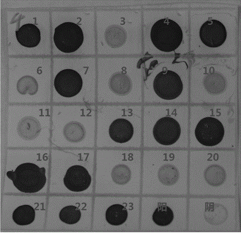 Hybridoma cell strain secreting monoclonal antibody against barley yellow dwarf virus GAV strain and application of monoclonal antibody thereof