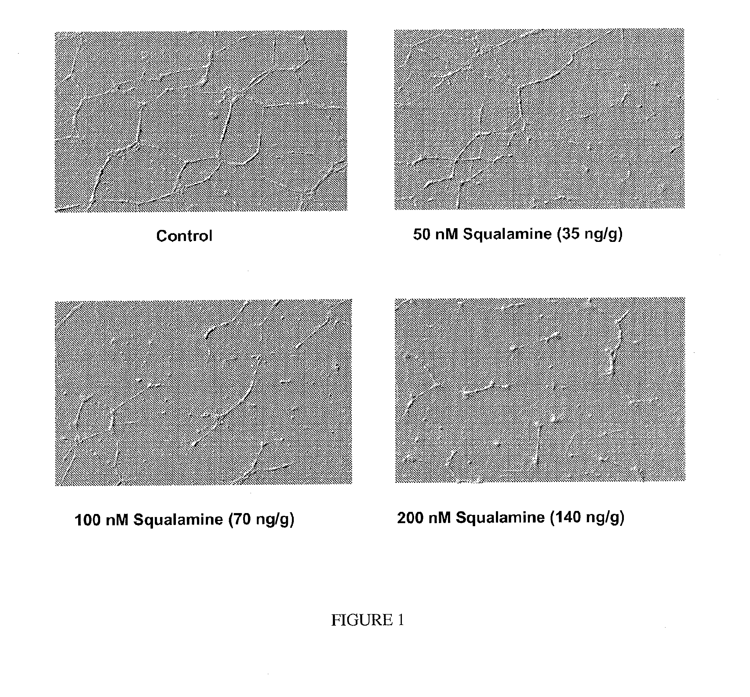 Ophthalmic Formulations of Squalamine